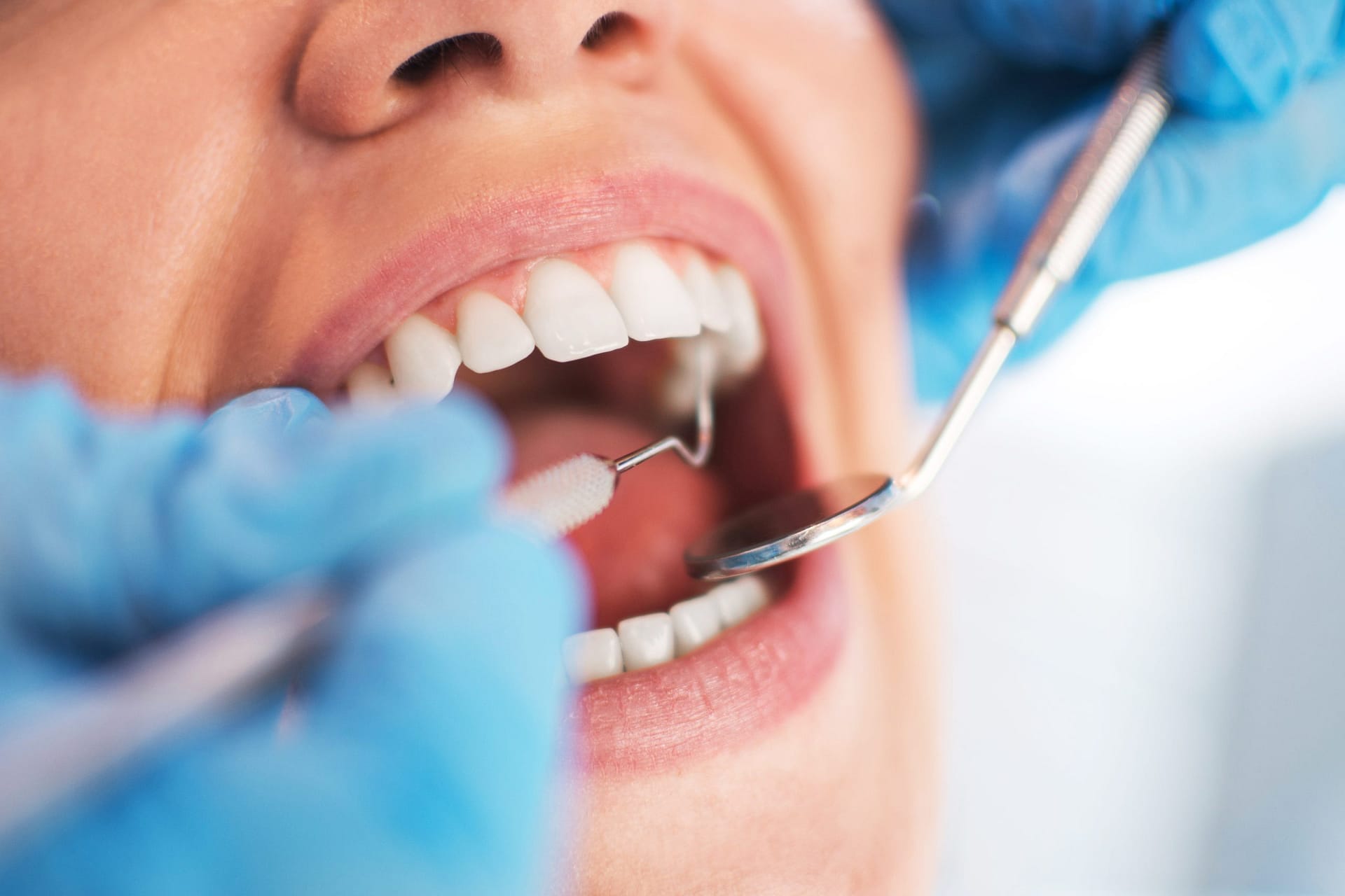 Dental health A6 Jönköping A dentist in Jönköping examines a patient's teeth using a dental tool, while the patient lies back with a protective bib - Tandhälsan A6 Jönköping - Dentist in Jönköping